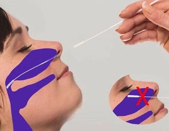 3ml NP Flok Sürüntü